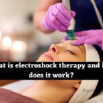 electroshock therapy
